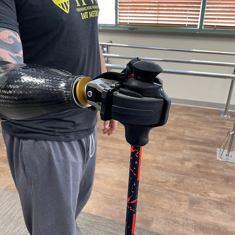 Person With Prosthetic Arm