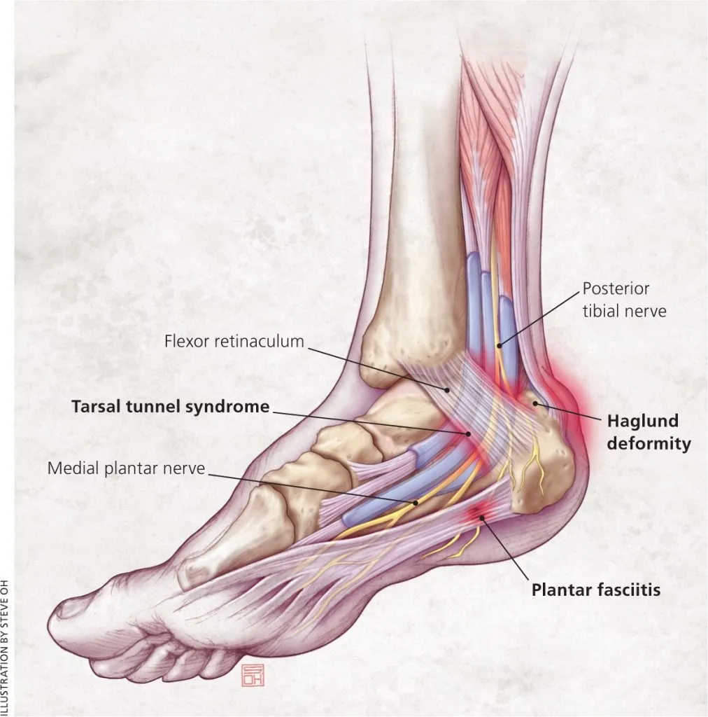 plantar foot anatomy nerves